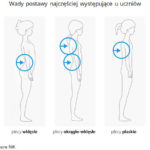 NIK-wady-postawy-1-typy-wad